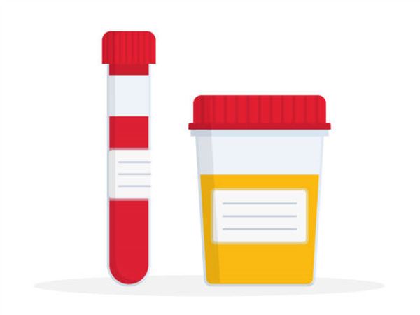 Urine and Blood